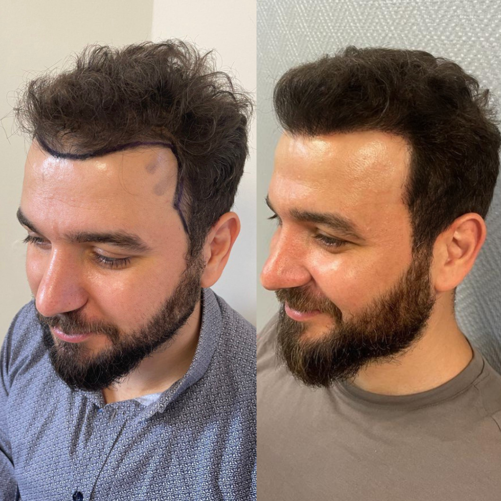 20230117_152646524_iOS