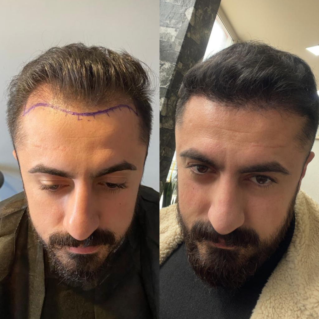 20230117_153309334_iOS