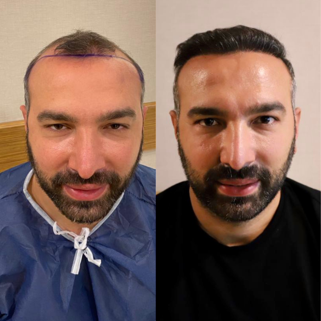 20230117_155500685_iOS