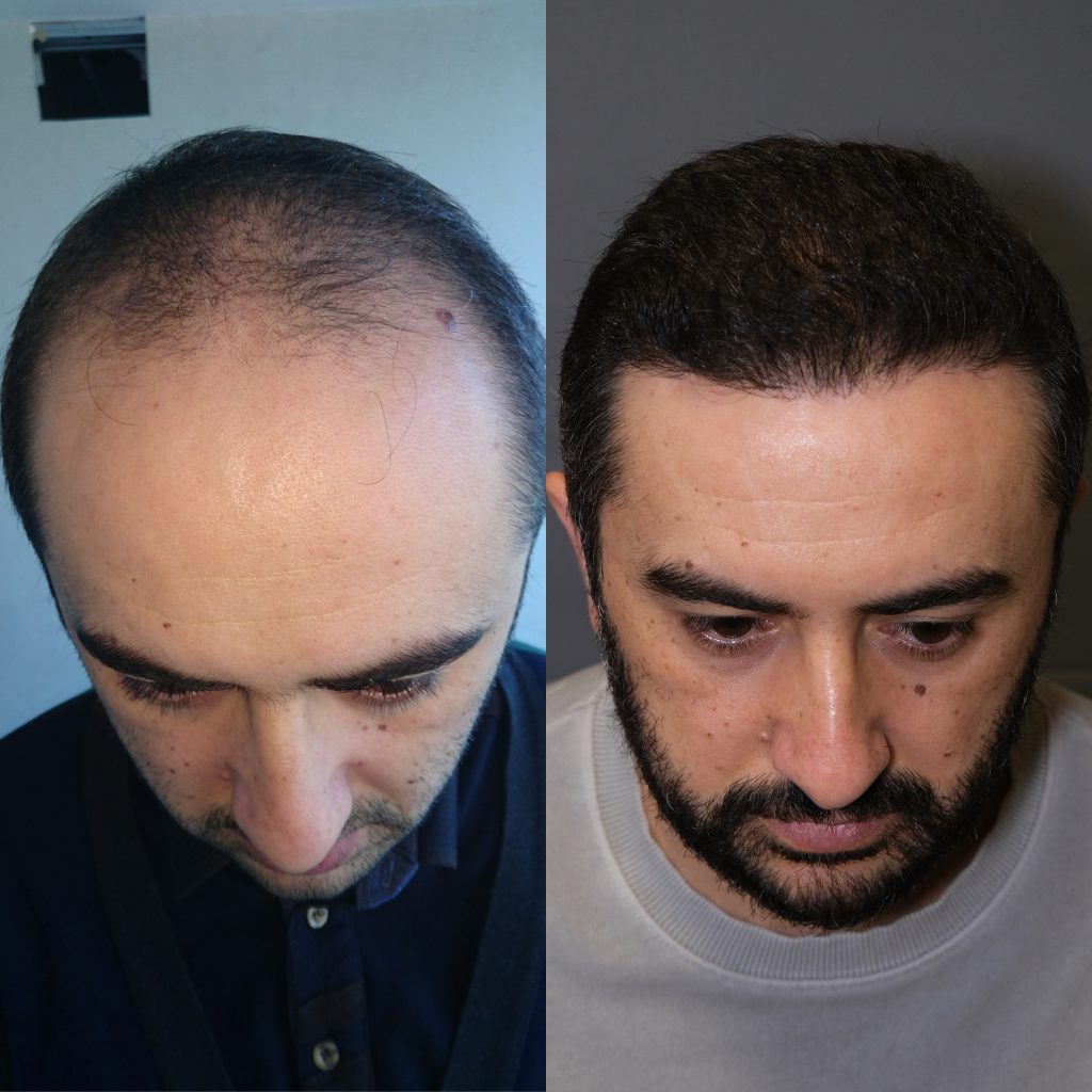 20230318_120053000_iOS