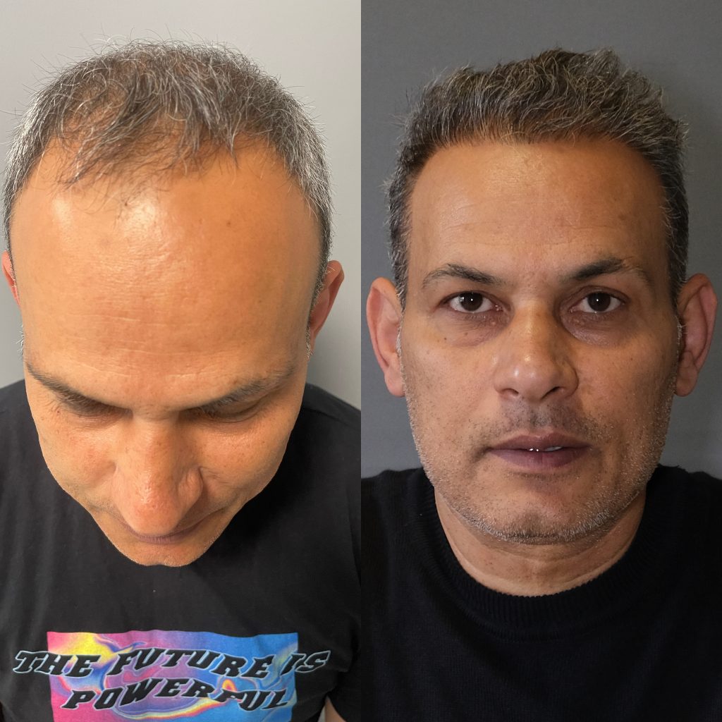 20230318_120727000_iOS