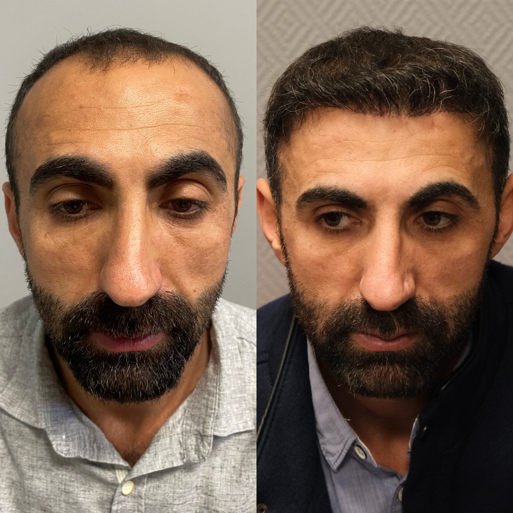 20230318_120819000_iOS