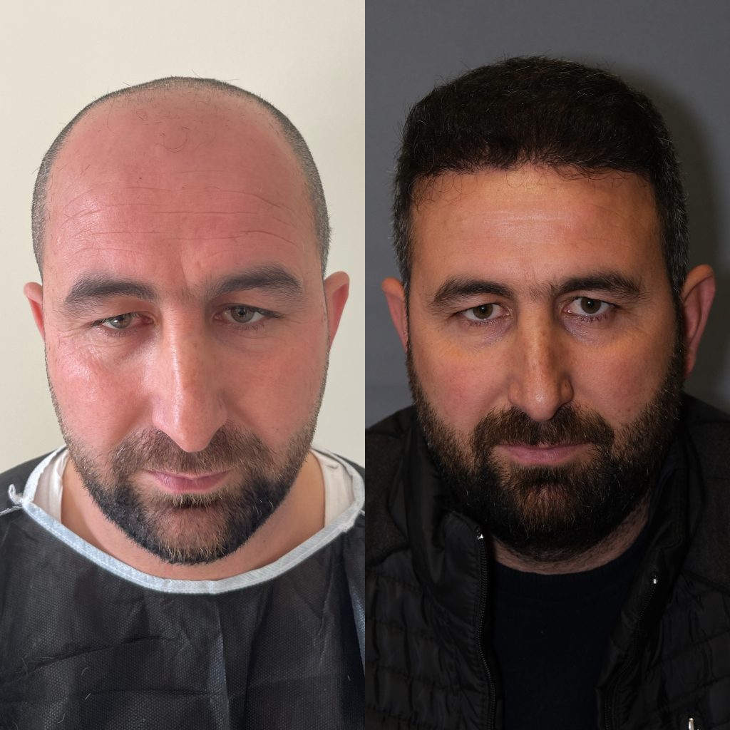 20230318_120913000_iOS