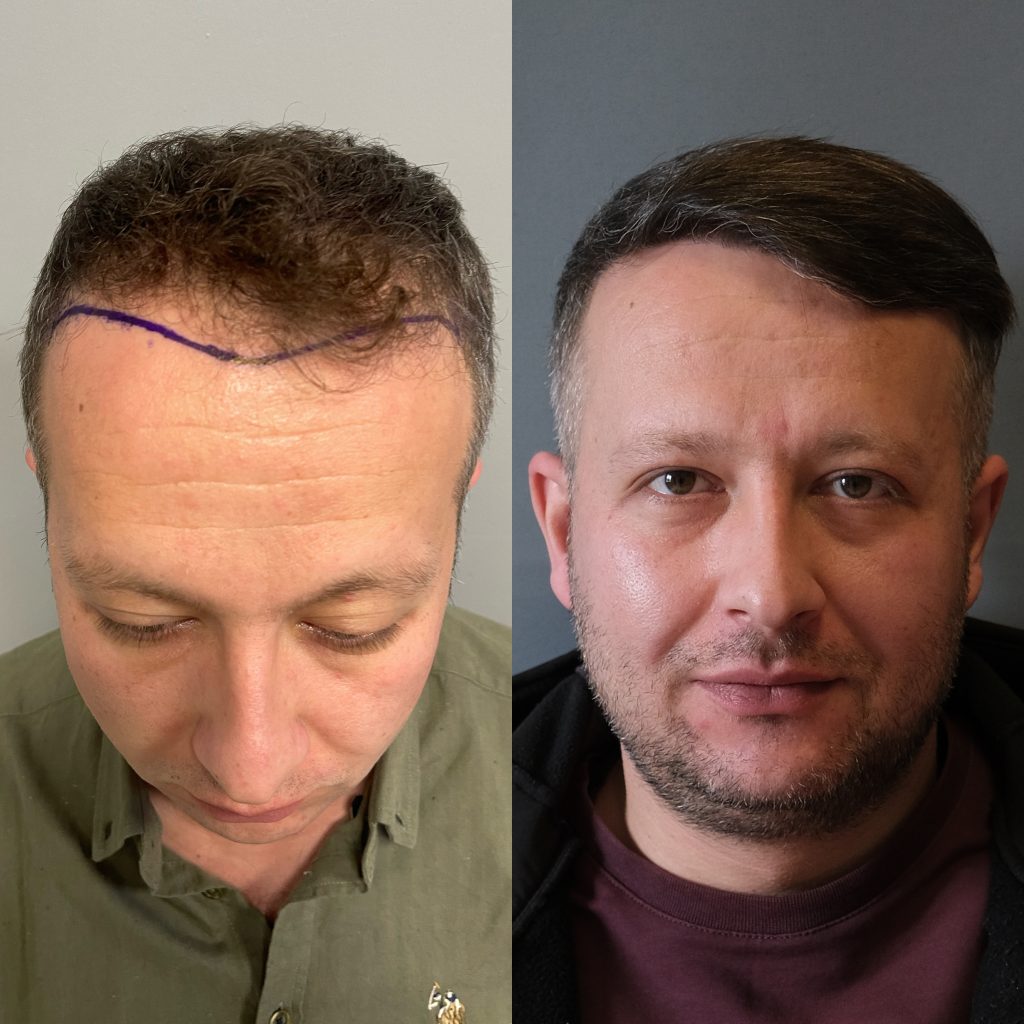 20230318_121102000_iOS