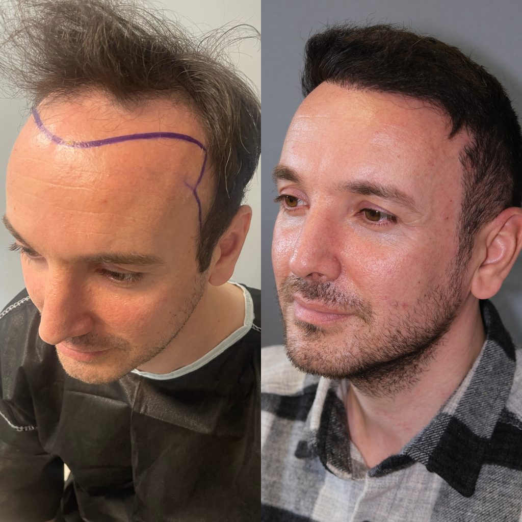 20230321_141338000_iOS