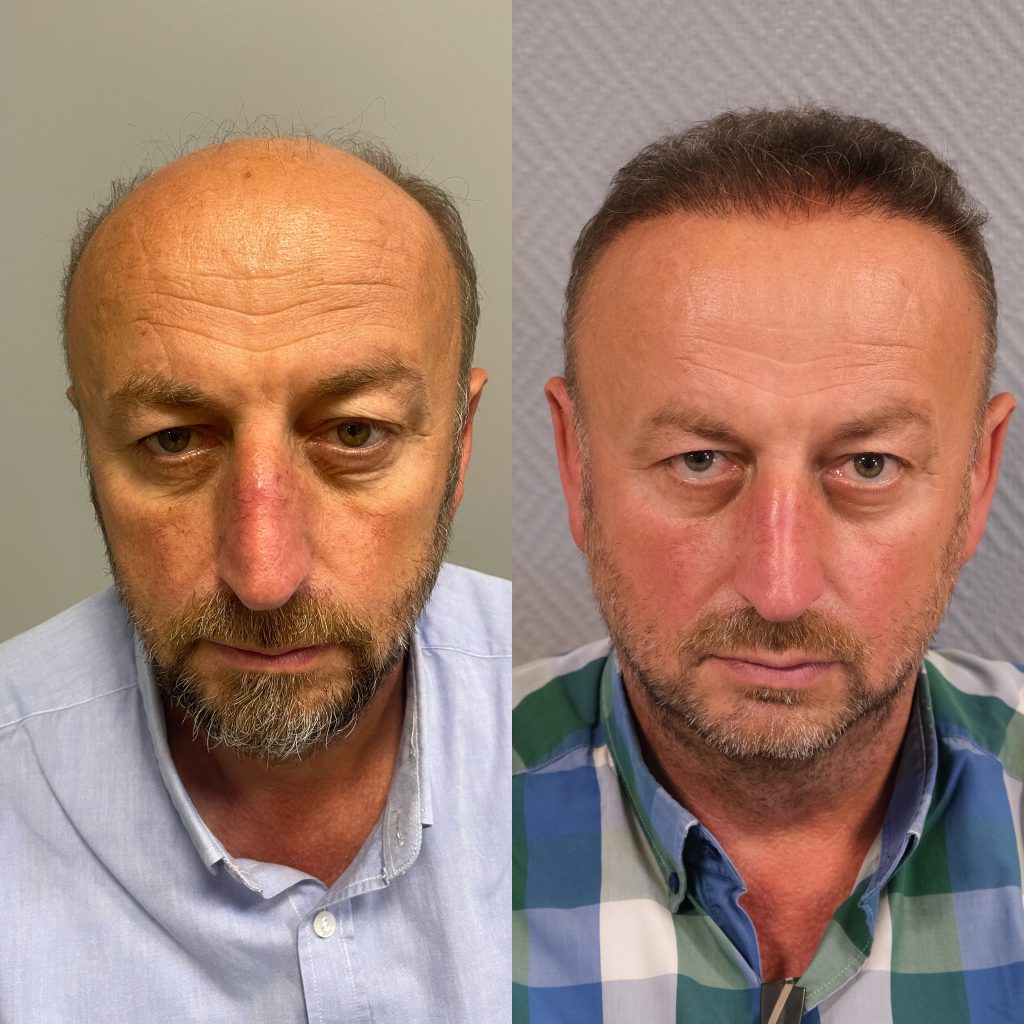 20230330_121907000_iOS