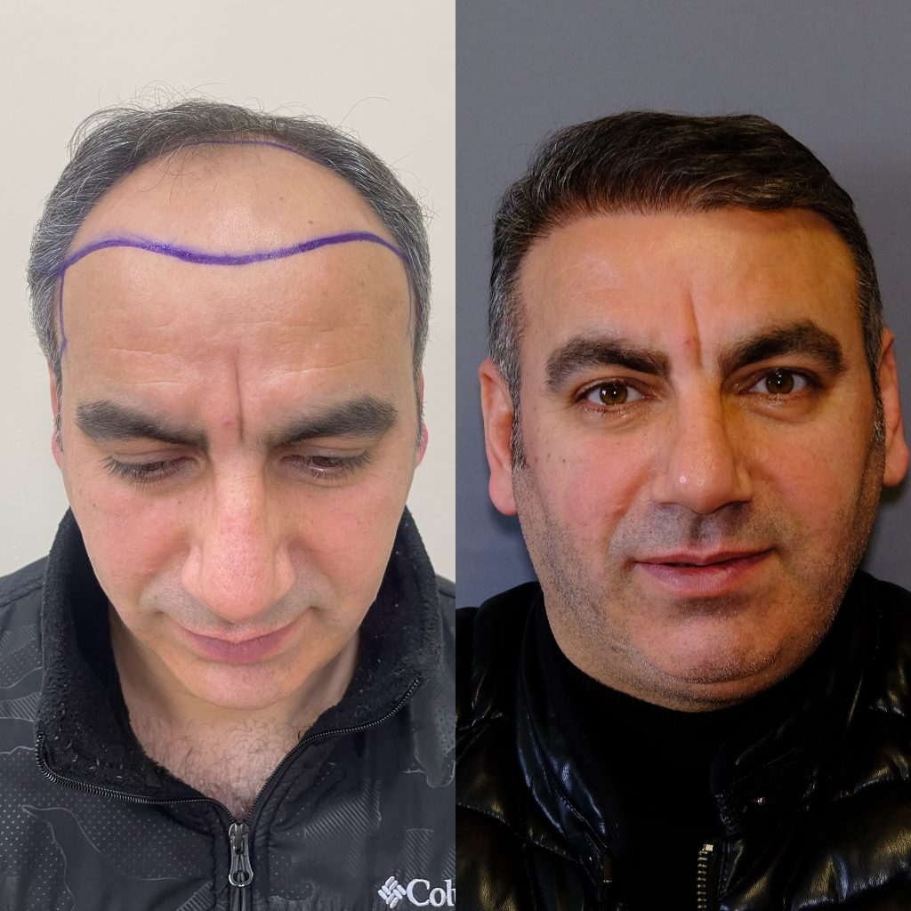 20230330_122042000_iOS