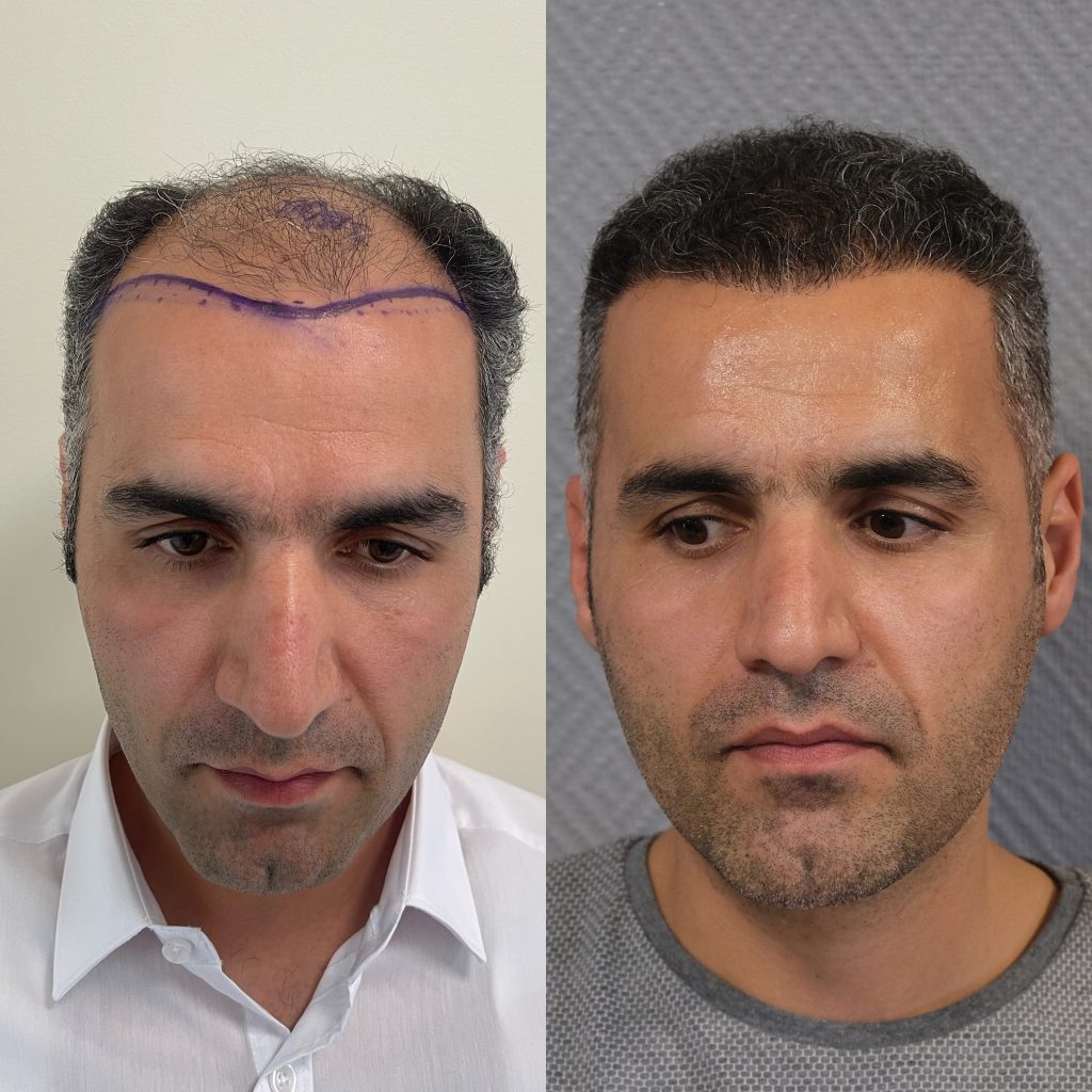 20230330_122315000_iOS